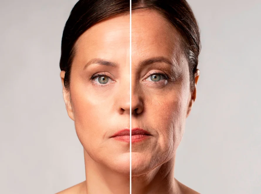 botox υαλουρονικό