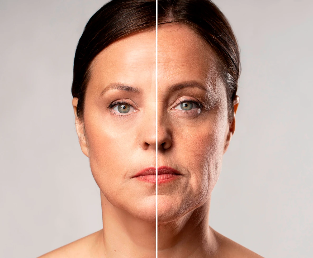 botox υαλουρονικό