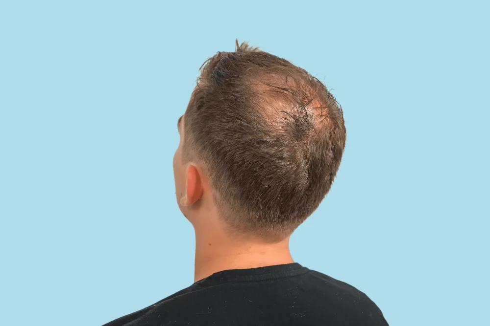 Before Image